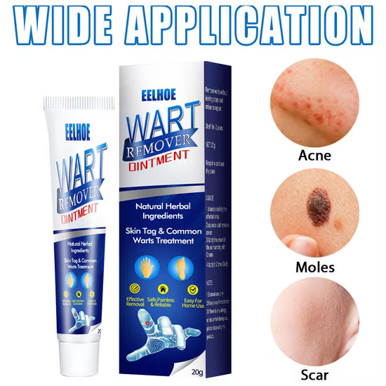 Pimple &. Wart removing ointment